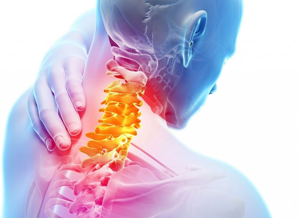 Mi a nyaki osteochondrosis
