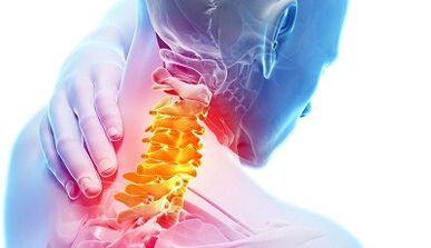A méhnyak osteokondrózisának okai