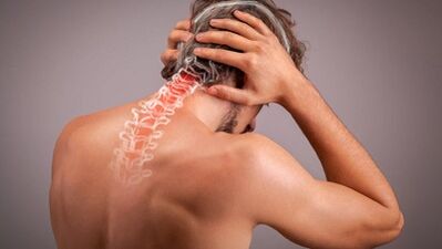 méhnyak osteochondrosis a férfiakban